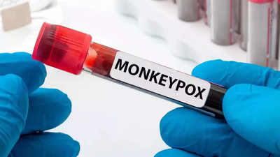 Delhi Monkeypox News: एक्सपर्ट बोले, संक्रमित से जानकारी लेकर हिमाचल में सोर्स को ट्रेस करने की जरूरत क्योंकि...