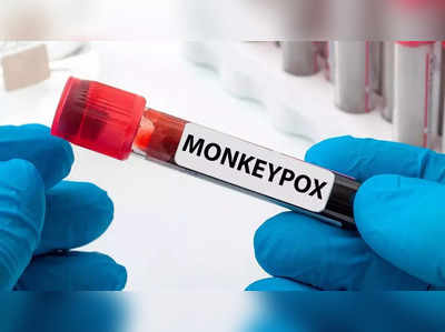 Delhi Monkeypox News: एक्सपर्ट बोले, संक्रमित से जानकारी लेकर हिमाचल में सोर्स को ट्रेस करने की जरूरत क्योंकि...