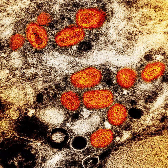 पुणे में आइसोलेट किया गया वायरस, बन पाएगी वैक्‍सीन
