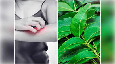 Itching Home Remedies: বর্ষার মরশুমে চুলকানিতে ভুগছেন? ঘরোয়া উপায়েই দ্রুত সমস্যা মেটান