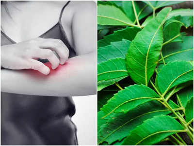 Itching Home Remedies: বর্ষার মরশুমে চুলকানিতে ভুগছেন? ঘরোয়া উপায়েই দ্রুত সমস্যা মেটান