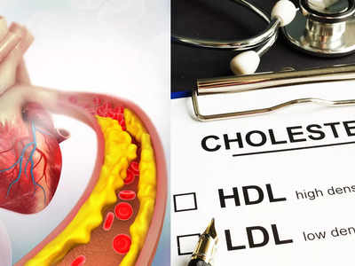 How To Raise Good Cholesterol: এই ৫ অভ্যাসই খারাপ কোলেস্টেরল বাড়তে দেয় না, রক্তের প্রবাহ ভালো রাখে!