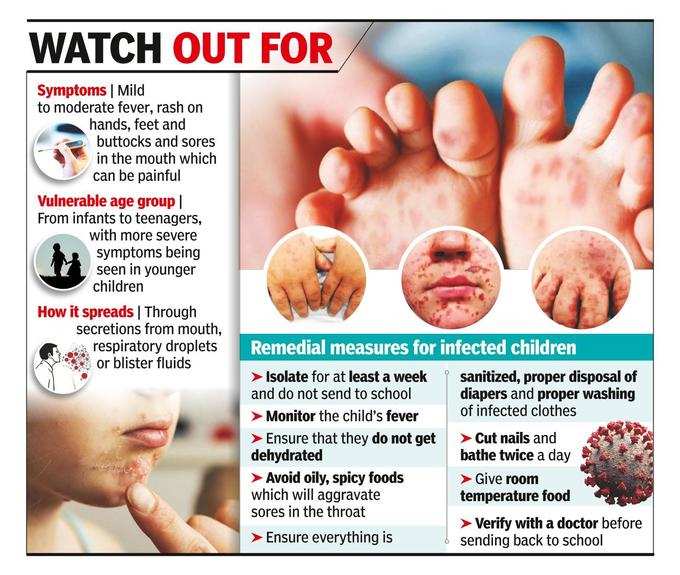 ​दिल्ली में भी हाथ, पैर और मुंह की बीमारी के आए मामले