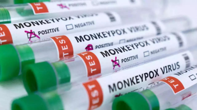 Monkeypox Case: ದೇಶದ ಮೊದಲ ಮಂಕಿಪಾಕ್ಸ್ ಪ್ರಕರಣದ ರೋಗಿ ಸಂಪೂರ್ಣ ಗುಣಮುಖ