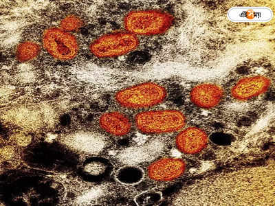 Monkeypox: দেহে মাঙ্কিপক্সের উপসর্গ, বিদেশ ফেরত কেরালার বাসিন্দার মৃত্যুতে আতঙ্ক