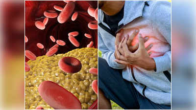 High Cholesterol Symptoms: কোলেস্টেরলের এই লক্ষণগুলি খালি চোখেই ধরা পড়ে! উপেক্ষা করলেই Heart Attack, Stroke-এর আশঙ্কা