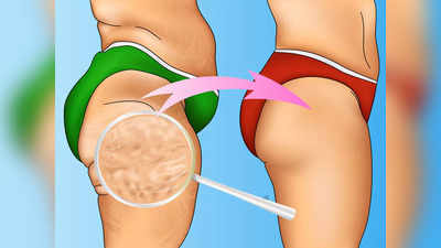 Cellulite treatment: जिम या क्रीम की अब नहीं जरूरत, 30 मिनट की ये खास मसाज हर हिस्से से हटा देगी सेल्युलाईट