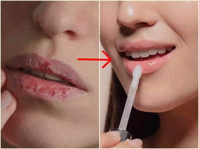 Lip Care Routine: ঠোঁট থেকে সব সময়ই চামড়া ওঠে? এই ঘরোয়া টোটকাতেই পাবেন গোলাপি ঠোঁট, শুধু ৭ দিন মেনে চলুন!