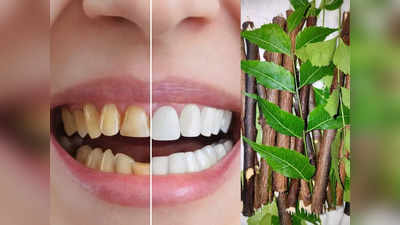 Teeth whitening: पीले दांतों को सफेद बनाने के 5 सस्ते आयुर्वेदिक तरीके, मुंह की बदबू-झनझनाहट भी होगी दूर