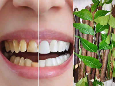 Teeth whitening: पीले दांतों को सफेद बनाने के 5 सस्ते आयुर्वेदिक तरीके, मुंह की बदबू-झनझनाहट भी होगी दूर