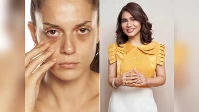 इन 3 कारणों से बढ़ रहे हैं आपके Dark Circles, डॉक्टर ने बताया इनका असरदार इलाज