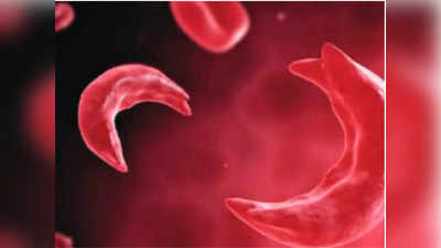 Sickle Cell Anemia: নজরে সিকল সেল অ্যানিমিয়া