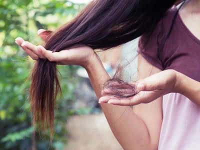 Hair Fall: বর্ষাকালে চুল উঠে উঠে টাক পড়ে যাচ্ছে? এই ঘরোয়া টোটকায় মাথা ভর্তি কালো চুল ফিরে পান মাত্র ১ মাসেই!