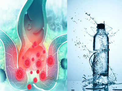 Hemorrhoids: ওষুধ বা অস্ত্রোপচার নয়, সস্তার এই প্রতিকার যে কোনও ধরনের পাইলস শেষ করবে নিমিষে