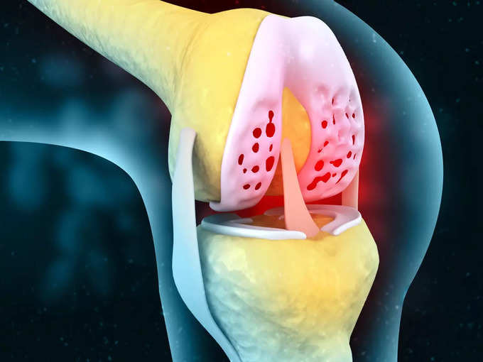 ​৫. চিকিৎসা জরুরি? (Rheumatoid Arthritis Treatment)