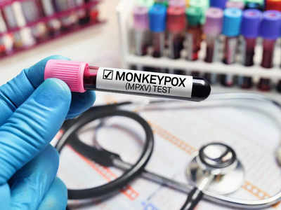 Monkeypox : వామ్మో.. శృంగారంతో కూడా మంకీపాక్స్ వస్తుందట..