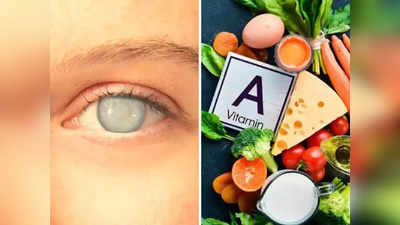 नाजूकश्या डोळ्यांना दगड बनवते Vitamin A ची कमतरता, या लोकांना जास्त धोका, ही 4 लक्षणं दिसताच व्हा सावध..!
