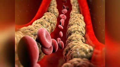 cholesterol: பேரிச்சம்பழம் சாப்பிட்டா கொலஸ்டிரால் குறையுமாம்... ஆனா இவ்வளவுதான் சாப்பிடணும்...