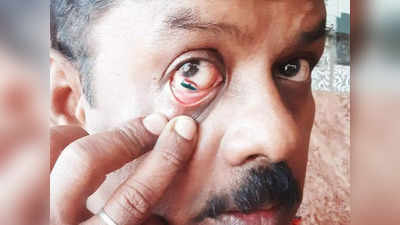 तमिलनाडु: 52 वर्षीय आर्टिस्ट ने आंख के अंदर पेंट किया तिरंगा, तस्वीरें हुईं वायरल