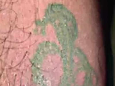 Cobra Bitten On Nagin Tattoo: ये कैसा संयोग! युवक के हाथ पर नागिन का टैटू, नाग ने वहीं डसा और गई जान