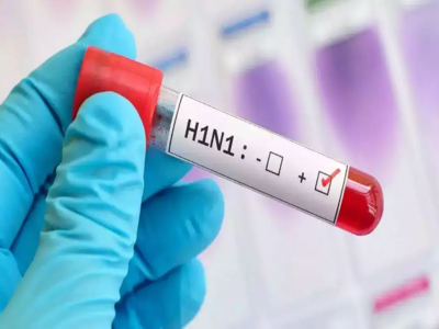 Swine Flu Case In Adilabad: ఆదిలాబాద్‌లో స్వైన్ ఫ్లూ కేసు నమోదు..