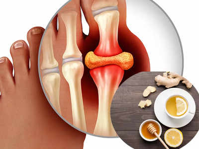 High Uric Acid In Blood: জয়েন্টে ব্যথা কিন্তু ইউরিক অ্যাসিড বৃদ্ধির লক্ষণ, গেঁটেবাত হওয়ার আগে এই ৪ পানীয় খাওয়া শুরু করুন