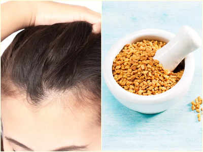 Methi Hair Packs: চুল উঠে উঠে মাথার সামনে ফাঁকা হয়ে যাচ্ছে? এভাবে মেথি লাগাতে পারলেই কাজ হবে ম্যাজিকের মতো!