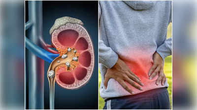 Kidney Stone Symptoms: শরীরের এই কয়েকটি জায়গায় ব্যথা হল কিডনি স্টোনের লক্ষণ! চিকিৎসকের পরামর্শে সতর্ক হলে এড়ানো যায় অপারেশন