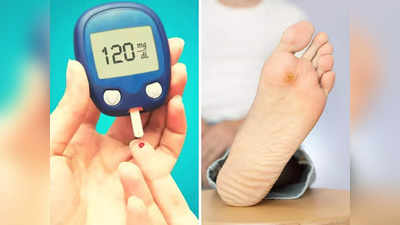 Diabetes Symptoms: ब्लड शुगर बढ़ने से पैरों पर नजर आते हैं ये 6 लक्षण, 5वां संकेत मिलते ही जाएं डॉक्टर के पास
