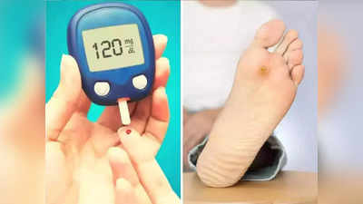 Diabetes Symptoms: सावधान, डायबिटीज होणार असेल तर पायांमध्ये दिसतात हे 6 बदल, 5 वा संकेत मिळताच जा डॉक्टरांकडे