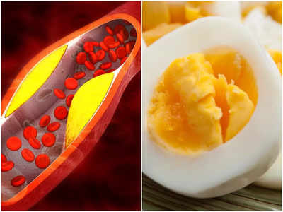 Egg Cholesterol Myth: কোলেস্টেরল রোগীও খেতে পারেন সাধের ডিমের কুসুম! কিন্তু কতগুলি? জানুন চিকিৎসকের মত