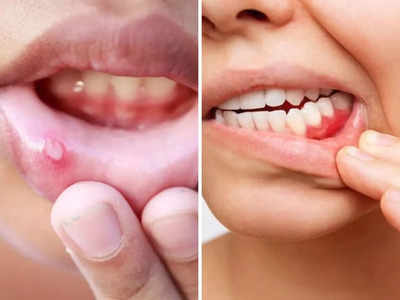 Health Tips: मुंह पर दिख रहे 5 लक्षण बता देंगे, आपके शरीर में धीरे से बढ़ रही कैंसर जैसी 16 गंभीर बीमारियां