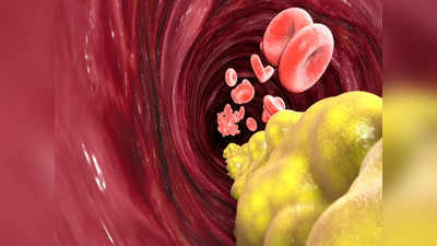 Cholesterol से भी डेंजर है Triglycerides, दिल की नसें कर देता है ब्लॉक, जानें इससे बचने के 5 तरीके