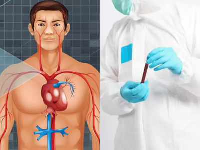 Cholesterolથી પણ વધુ જોખમી Triglycerides; હૃદયની નસો કરી દેશે બ્લોક, બચવાના 5 ઉપાય