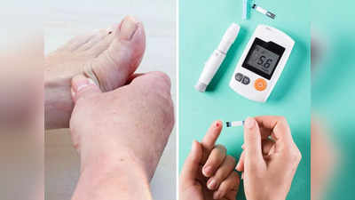 Diabetes होने से पहले होती है ये बीमारी, पैर के सुन्न होने समेत दिखते हैं ये 7 लक्षण, जाने बचाव के उपाय