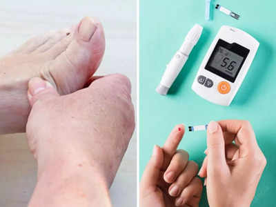 Diabetes होने से पहले होती है ये बीमारी, पैर के सुन्न होने समेत दिखते हैं ये 7 लक्षण, जाने बचाव के उपाय