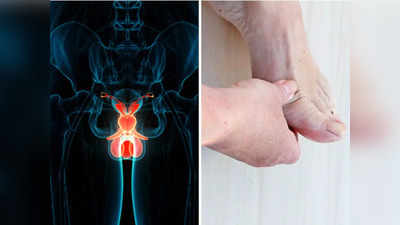 पैर में दिख रहे इस एक संकेत से जाने आपको हो गया है Prostate cancer, ये 5 इशारे भी न करें इग्नोर