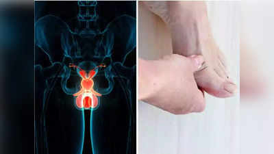 पुरुषहो सावधान, पायात हे 1 गंभीर लक्षण दिसल्यास समजून जा तुम्हाला झालाय प्रोस्टेट कॅन्सर, अजिबात करू नका दुर्लक्ष