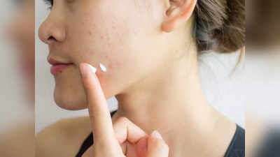 Acne Remedies: പ്രസവ ശേഷം വരുന്ന മുഖക്കുരുവിന് പരിഹാരം