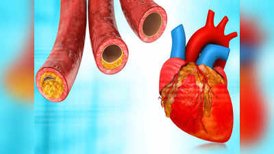 Test for heart disease: समय रहते करा लें ये 7 टेस्ट, टल जाएगा हार्ट अटैक, दिल के रोग और स्ट्रोक का खतरा