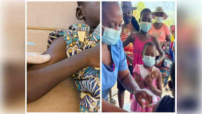 zimbabwe measles: చిన్నారులను బలి తీసుకుంటున్న మీజిల్స్ వ్యాధి...  700 మంది మృతి