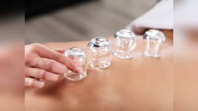 Cupping Therapy: ఈ థెరపీతో.. ఈజీగా బరువు తగ్గుతారు, సేఫ్‌ కూడా..!