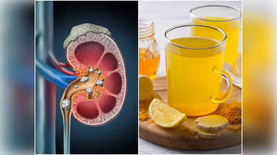 Kidney Stones Diet: এই ৫ শরবত বানিয়ে খেলেই কিডনি স্টোন গলে বেরিয়ে যায়, সন্ধান দিলেন বিশিষ্ট পুষ্টিবিদ