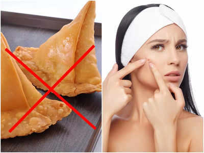 Bad Foods For Skin: এই ৫টি খাবার ত্বকের জন্য বিষ! ভালো চাইলে আজই খাওয়া বন্ধ করুন