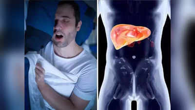 Fatty Liver Disease : झोपण्याशी संबंधित ही सवय वाढवते लिव्हर सडण्याचा धोका, ताबडतोब बदला नाहीतर होईल लिव्हर फेल