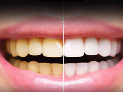 पीलेपन से छुटकारा देने के साथ दांतों को मजबूत बना सकते हैं ये Teeth Whitening Powder, मसूड़ों के लिए भी हैं सुरक्षित