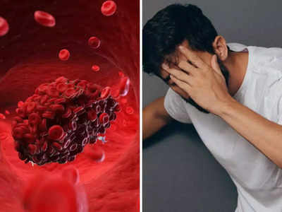 Blood Clotting Sign : नसांमध्ये रक्ताची गुठळी आढळल्यास होऊ शकतो मृत्यू , या 5 लक्षणांना हलक्यात घेऊ नका