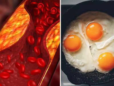 Eggs And Cholesterol: কোলেস্টেরলের জন্য ডিমে ভয়, সেলেব পুষ্টিবিদ কী বলছেন জেনে নিন