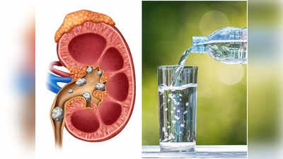 Causes of Kidney Stone: আপনার এই সাধারণ ভুলেই কিডনিতে পাথর জমে আকারে বাড়ছে, সতর্ক করলেন চিকিৎসক