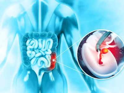 cancer : வயிற்று புற்றுநோய் ஏன் வருகிறது... வந்தால் அது என்னென்ன உறுப்புகளை பாதிக்கும்...